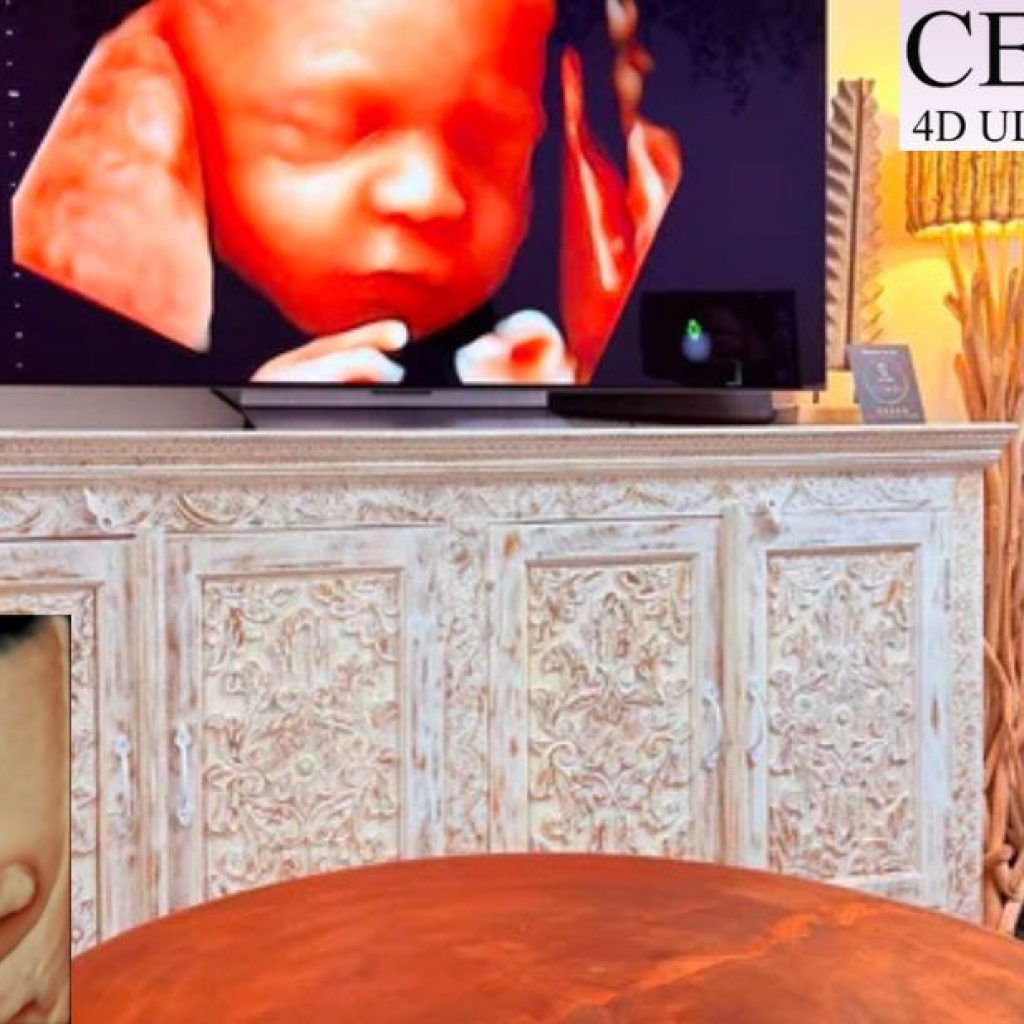 Capture precious moments with a 3D/4D ultrasound in Perth Capture precious moments with a 3D/4D ultrasound in Perth