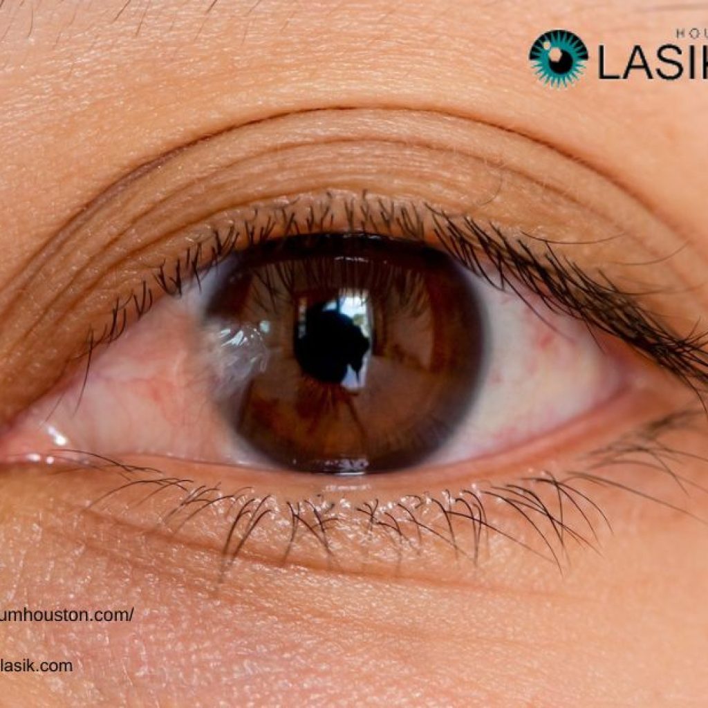 Pterygium Surgery Recovery | Pterygiumhouston.com Pterygium Surgery Recovery | Pterygiumhouston.com