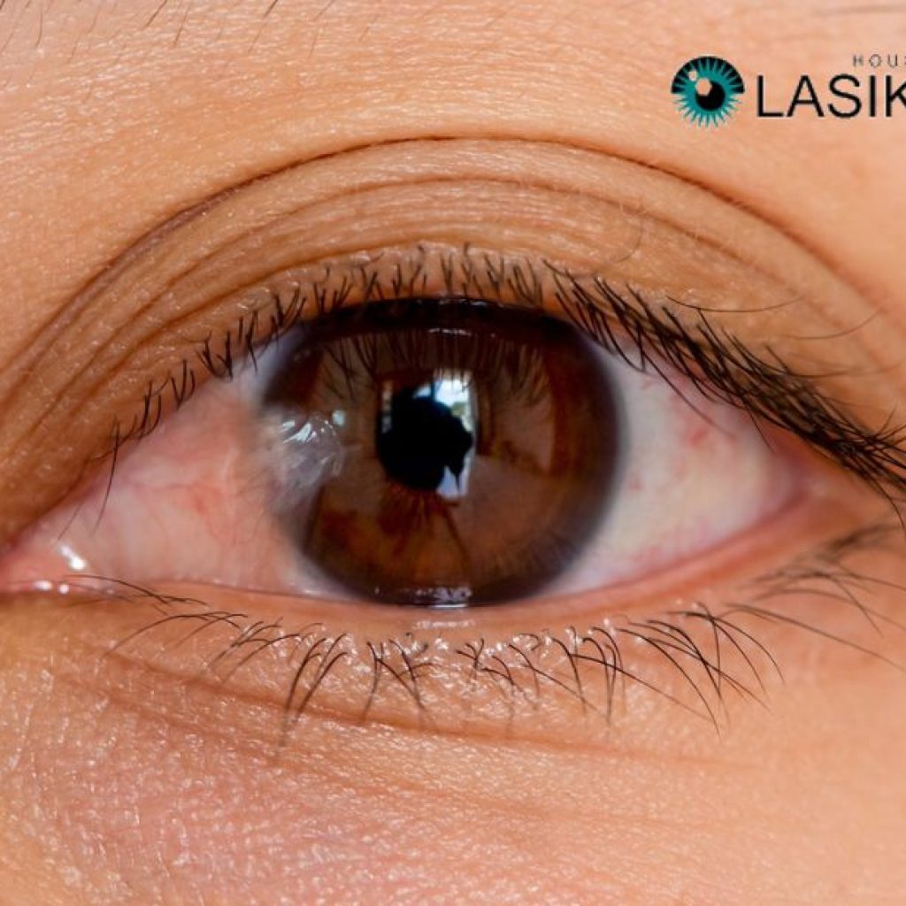 Gentle Options for Pterygium Removal and Eye Health Gentle Options for Pterygium Removal and Eye Health