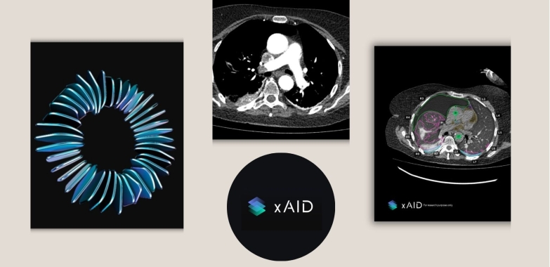 How AI Radiology Reporting Improves Workflow Efficiency